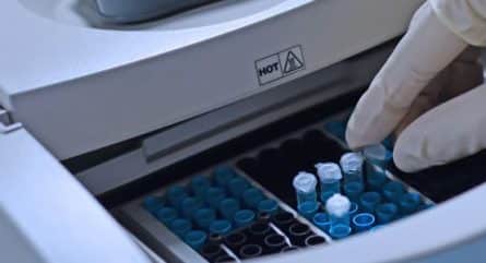 Understanding Cq values in PCR
